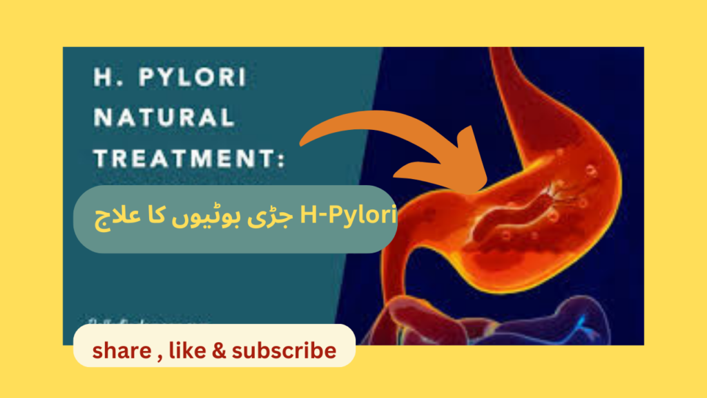 H-pylori herbal treatment