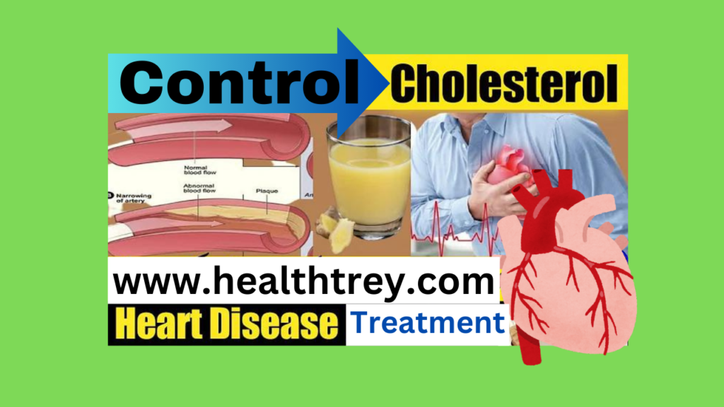 Treatment Cholesterol causes heart attacks