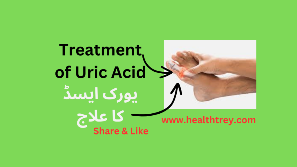 Treatment of Uric Acid